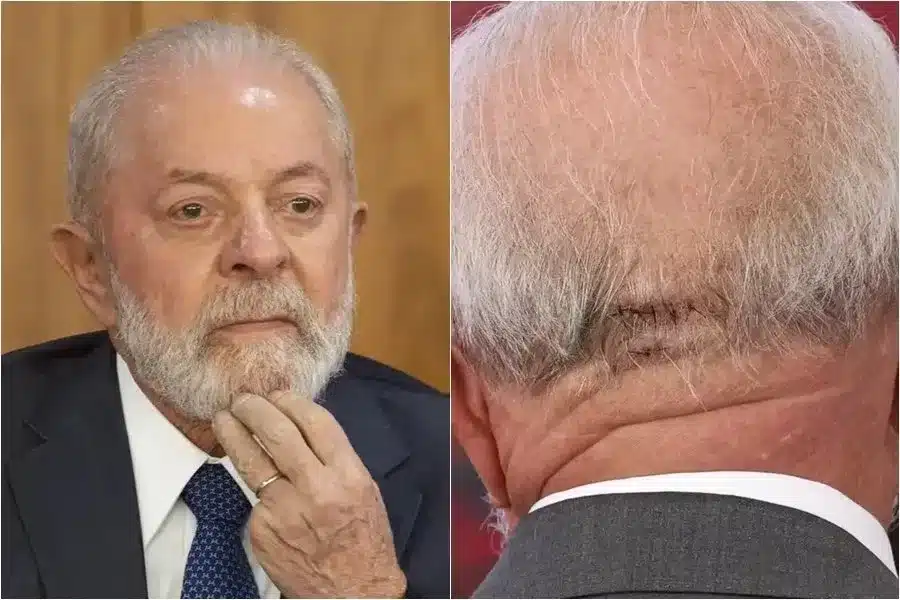 LULA